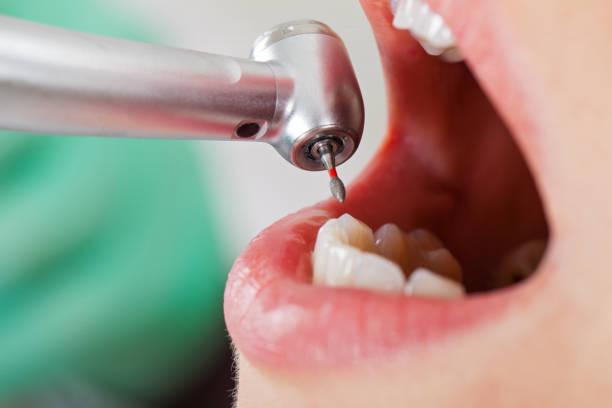 Best Broken or Cracked Tooth Emergency Dentist in Progress, PA
